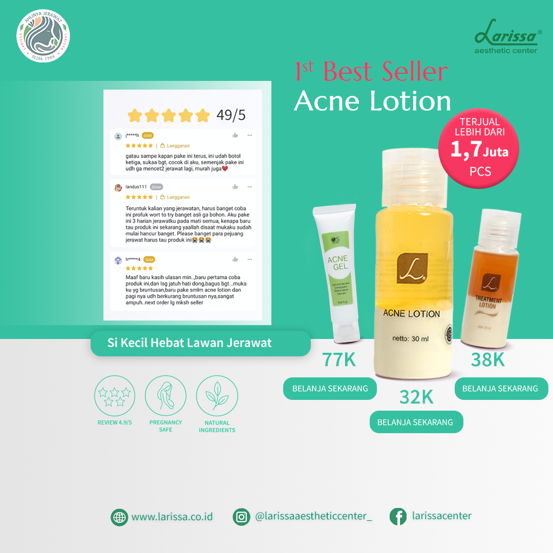 best seller produk larissa aesthetic center kategori obat totol jerawat : acne lotion larissa