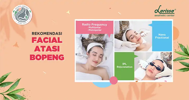 Rekomendasi Facial Atasi Bopeng