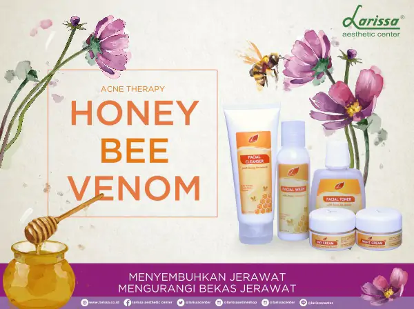 Solusi Bebas Jerawat "Larissa Honey Bee Venom"