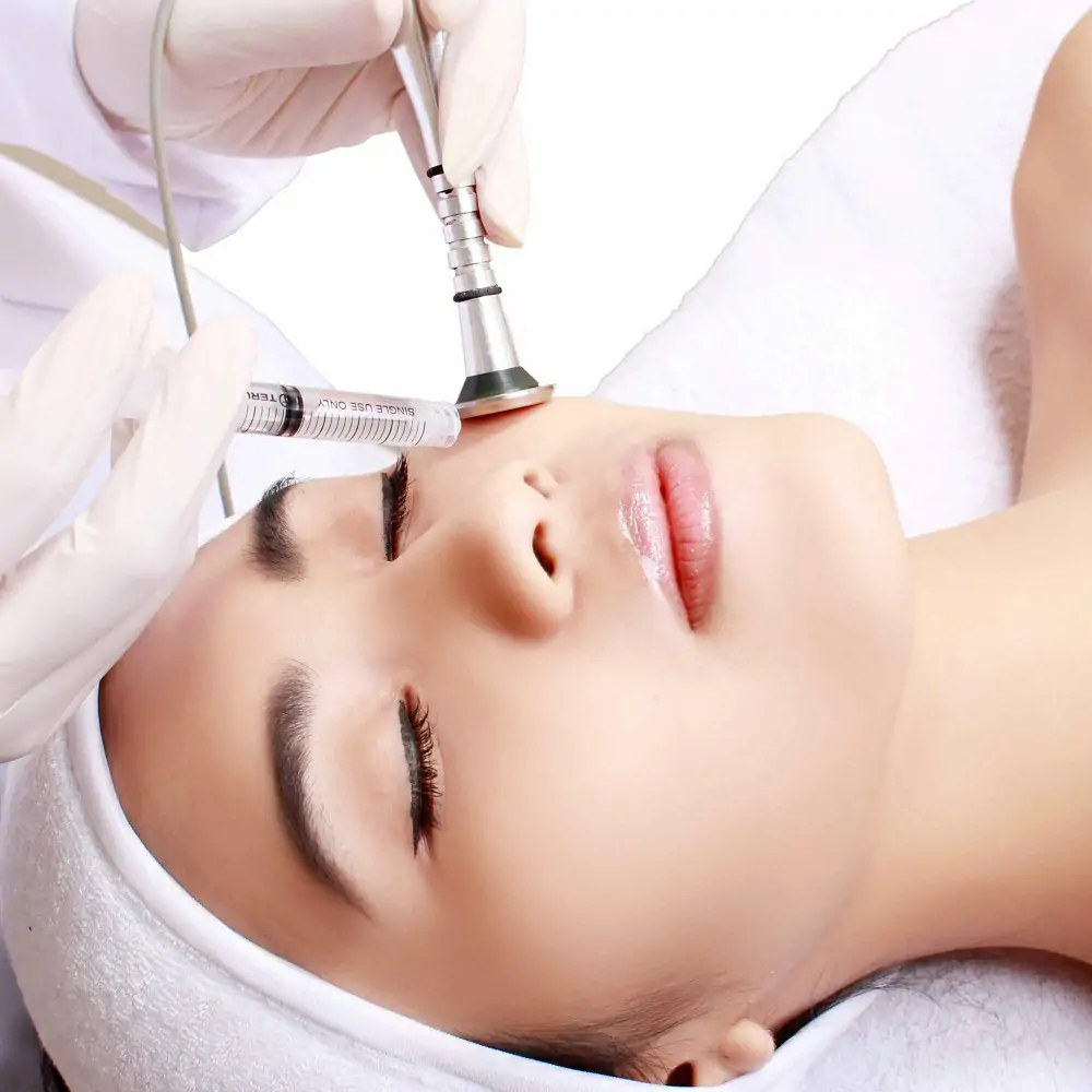 Jerawat Tuntas Dengan Larissa Mesotherapy Acne Control Without Needle