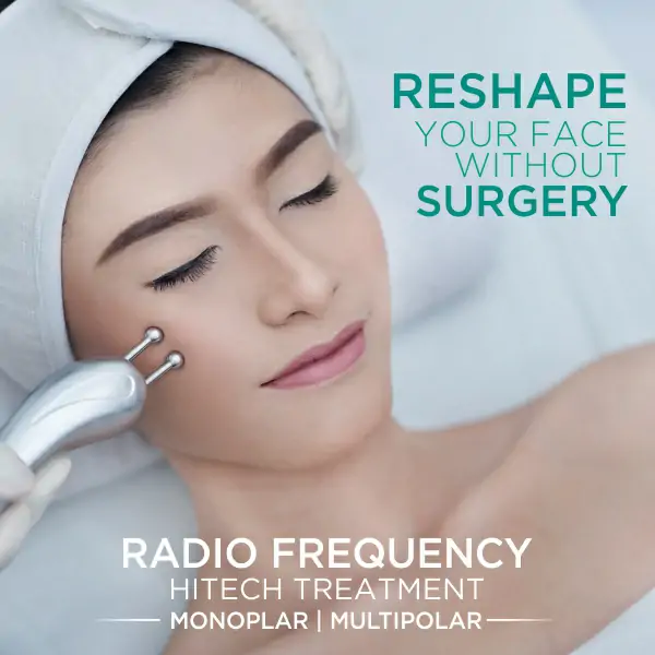 Tiruskan Pipi Chubby mu Dengan Treatment Ini