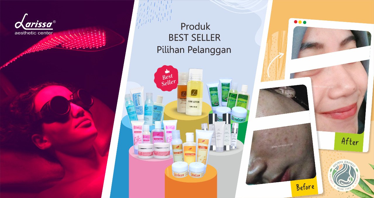 Review Produk & Facial, Cara Menghilangkan Jerawat Paling Ampuh