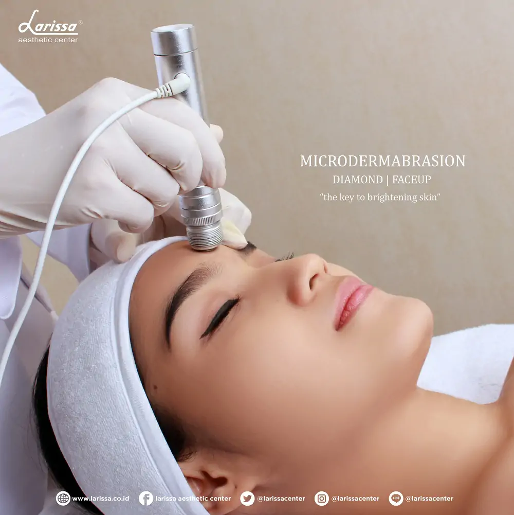 Cerah Glowing, Bebas Bekas Jerawat dan Bopeng dengan Microdermabrasion Larissa