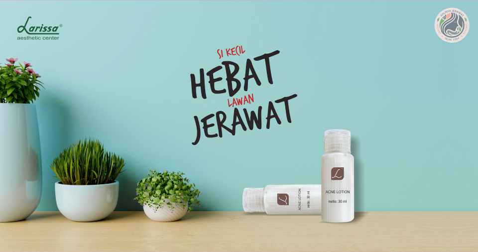 Produk Jerawat Acne Lotion Larissa