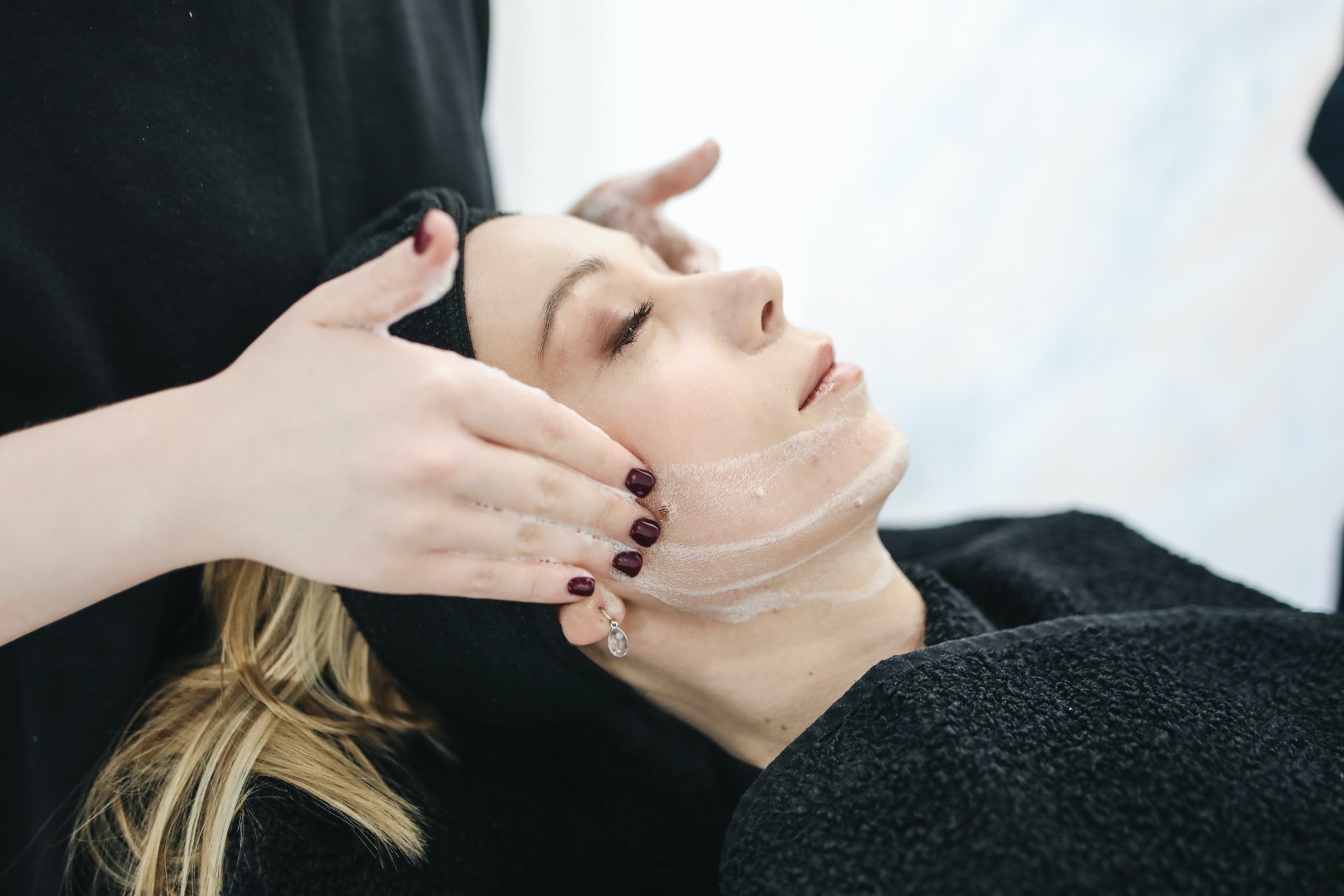 Hilangkan Flek Hitam dengan IPL Dark Spot