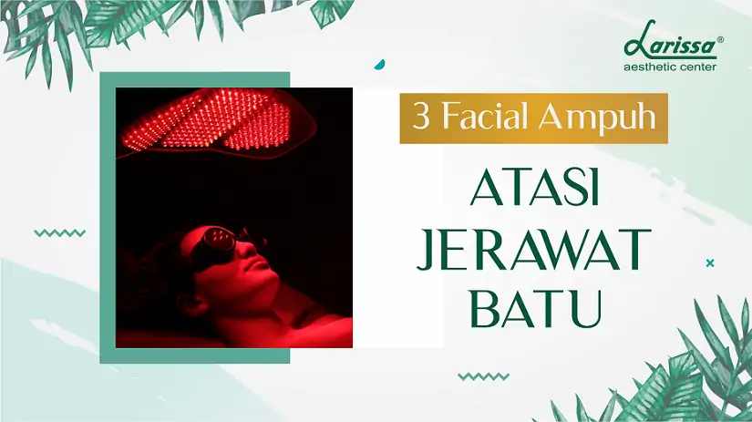 3 Facial Ampuh Atasi Jerawat Batu