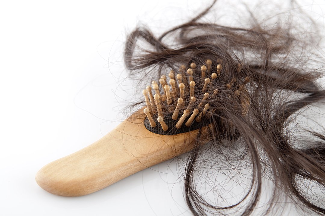 Rekomendasi Shampo Untuk Rambut Rontok Terbaik Yang Wajib Kamu Coba