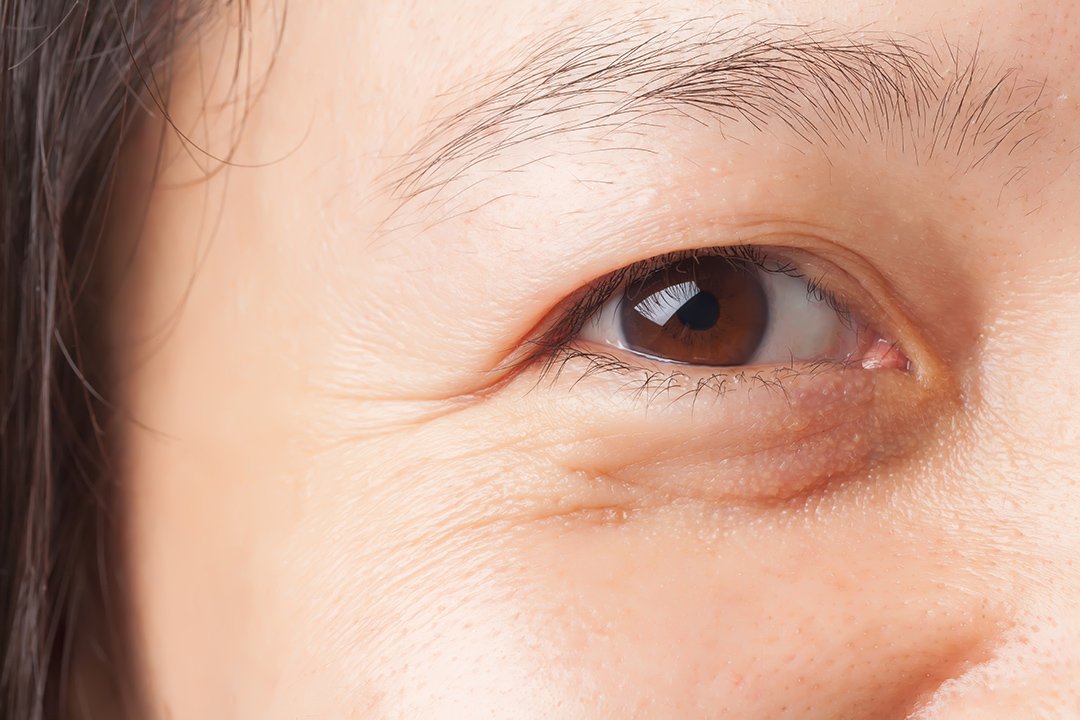Masih Muda, Emang Udah Harus Pakai Eye Serum?