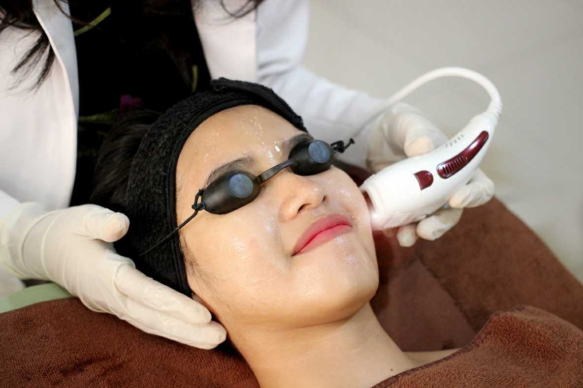 Intens Pulsed Light (IPL)