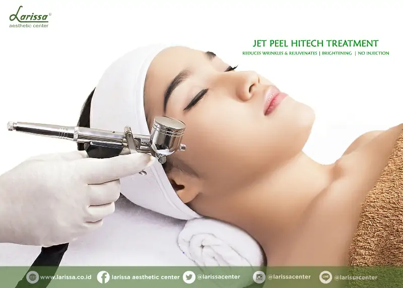 Larissa Ozone Jet Peel Hitech, Cerahkan dan Lembutkan Kulit Wajah