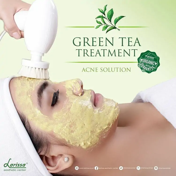 Cantik Alami Bebas Jerawat Dengan Green Tea Facial Larissa