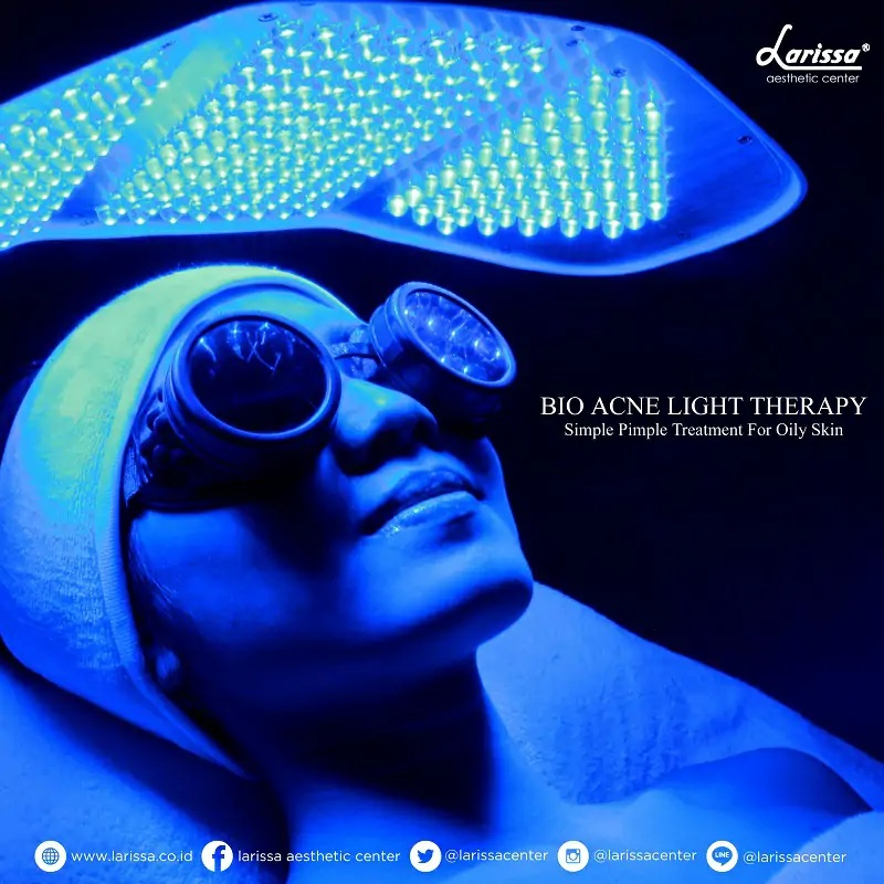 Jerawat Hilang dengan Bio Acne Light Therapy ( No Pain - No Needle - No Downtime)