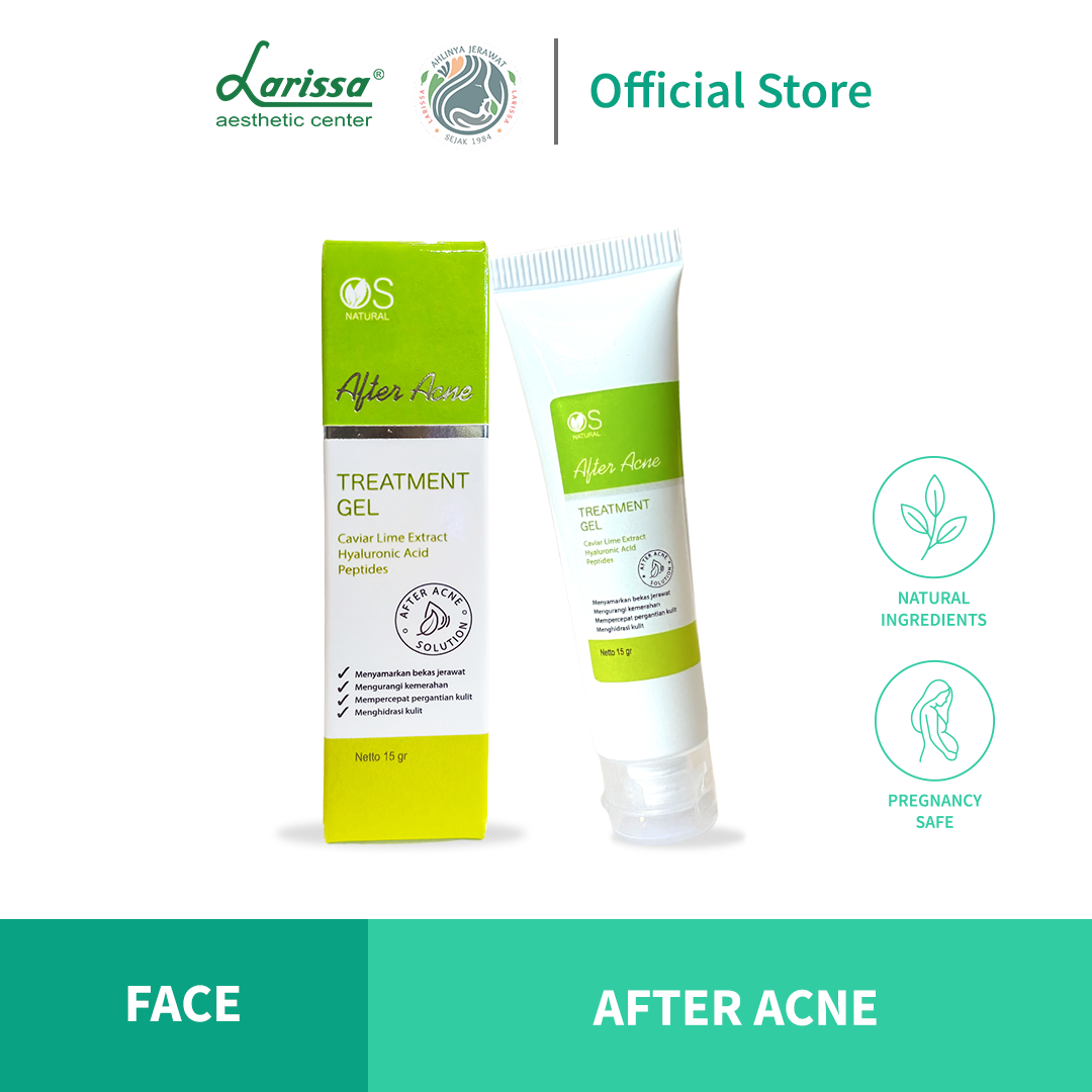 OSN After Acne Treatment Gel